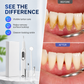 ⏳Time-Limited Special⏰Portable Ultrasonic Teeth Cleaner and Tartar Remover Set